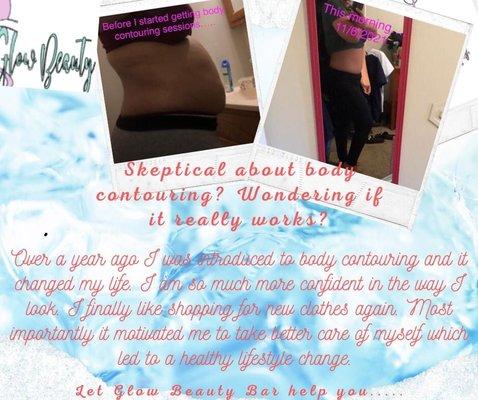 Personal body sculpting journey from one of Glow Beauty Bars owners