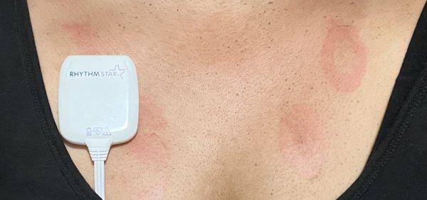 Cardiovascular Institute Of San Diego