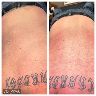 Full back wax, before & after