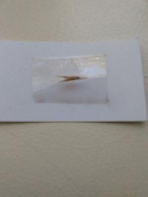 The Vet totally misdiagnosed the foxtail infection.