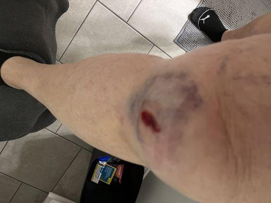 Home Depot hires Sedgwick just to keep people off there back. Don't shop there. They're all scum.