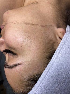 Dermaplaning Facial