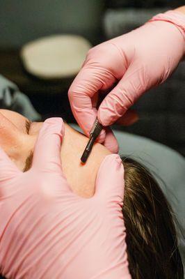 Dermaplaning at Dynamic Rejuvenation!