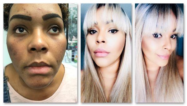 Medically supervised weight loss, JetPeel for skin and Lip rejuvenation...beautiful!