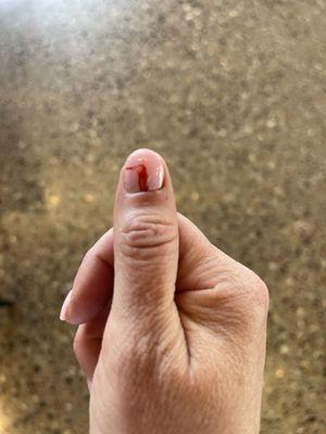 Nail tech kept cutting me with the drill. If I just bump 3 of my fingers they start to bleed.