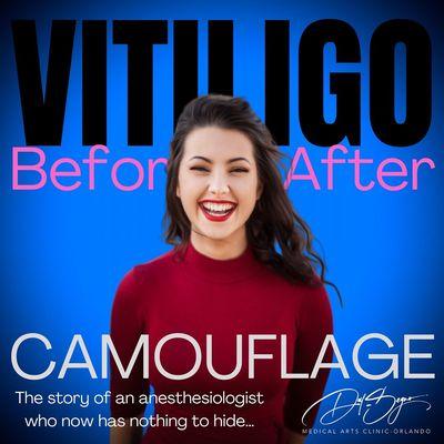 Specialized tattooing methods by world class MD-tattoo artist