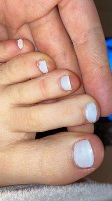 Terrible toes.