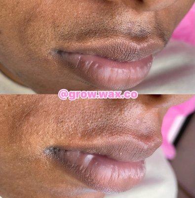 Upper Lip Wax