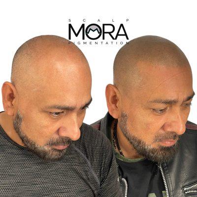 Huge transformation for this client after a few sessions with us