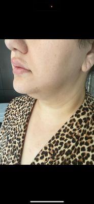 Paul S Thesiger, MD - Thesiger Plastic Surgery