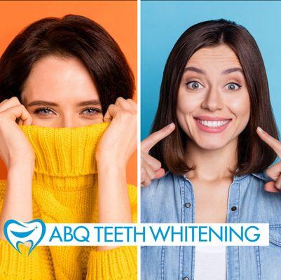 #laserteethwhitening #teethwhitening #whiteteeth #albuquerque