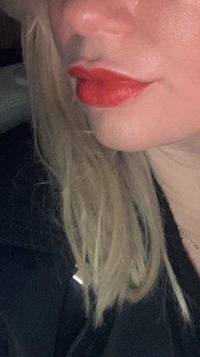 Lips fully healed. Natural yet plump ;)