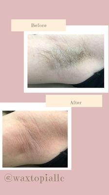 Female Underarm Wax