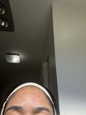 Terrible facial