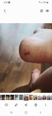 The day after my pedicure...