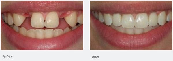Richard B Waghalter DDS - Healthy Smiles