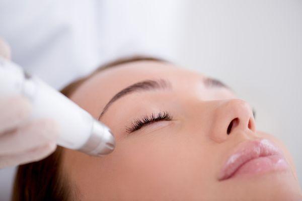 Microneedling
