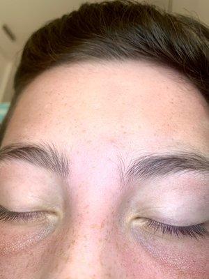 After between brow sugaring