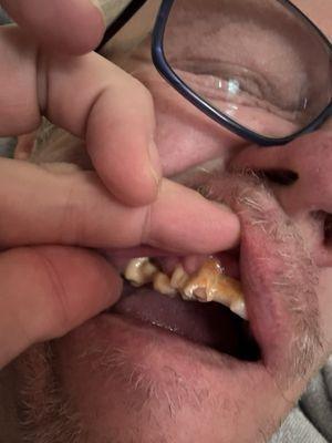 My teeth were so much better, and I wasn't in pain, before coming here.