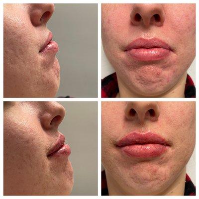 All Buttered Up Beauty Bar & Med Spa