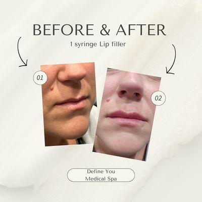 Define You Medical Spa