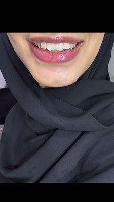 Luxeskinbyhanadi