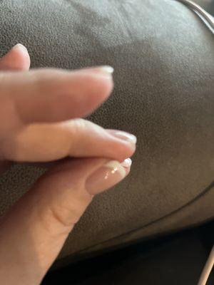 How cut off they are I can't even scratch an itch!