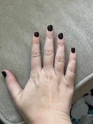 4 out of 5 fingers chipped, and other hand just as bad.