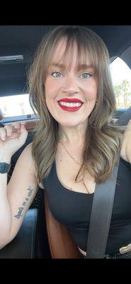 After: Lip filler, Dysport, weight loss from Semaglutide