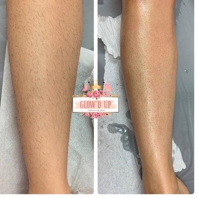 Check this leg wax out!