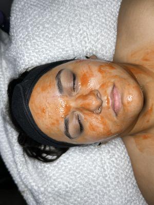 Dermaplaning facial