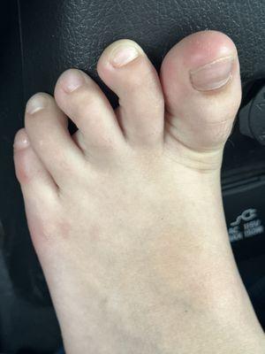 Free feet pic