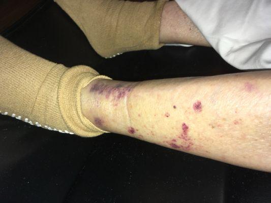 Hopkins Center for Rehabilitation & Healthcare