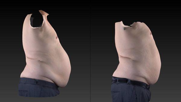 Before and after body sculpting result at Bodhi & Sculpt Co.