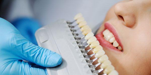 Veneers and Lumineers