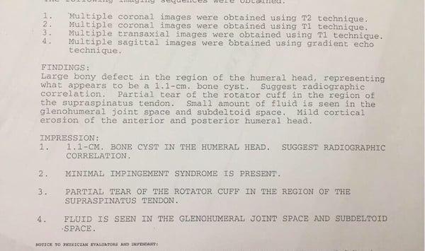 All these issues on my husband's shoulder and all what that Dr did is send him therapy.