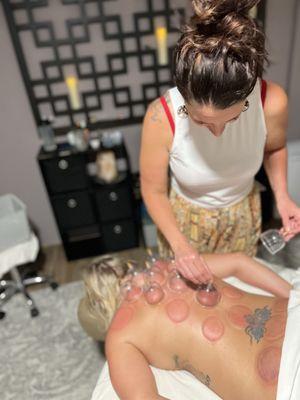Cupping therapy