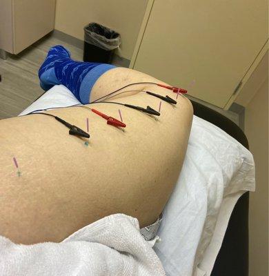 X Factor Physical Therapy & Wellness Center