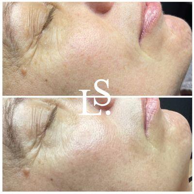 Lisa Sean Advanced Skin Care