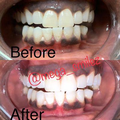 Safe & Effective Teeth Whitening. Same day results! 60min session $125 or 80min session $150 310*692-1135 *Mention yelp receive $10.00 OFF!