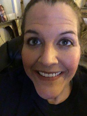 Beautiful new smile!