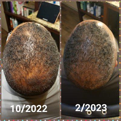 Hair Rejuvenation Center