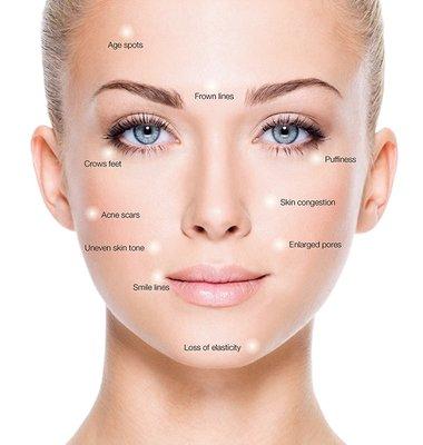 Just some of the things an amazing BB Glow Facial can rejuvenate & improve!