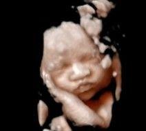 3d4d ultrasound in Jeffersonville Indiana