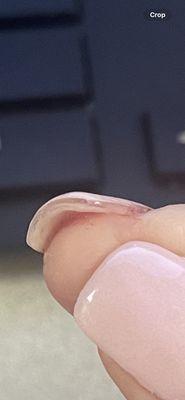 Layer of acrylic between real nail and pink dip powder that was not fully soaked off