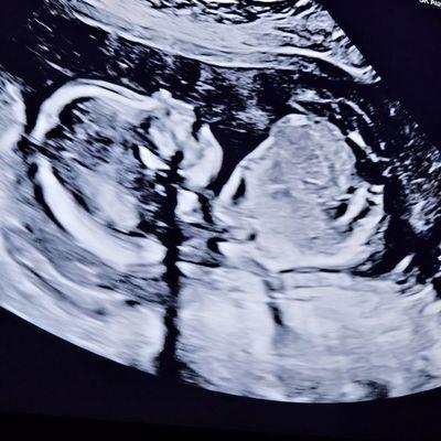 Desert Maternal Fetal Medicine