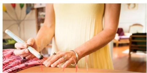 Acupuncture By Sarah West