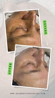 Skin Revive By Nicki