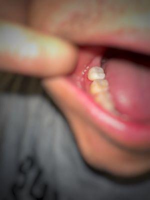 Butterfly Dental Care