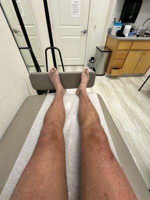 Houston Fibroids - Clear Lake Fibroid Clinic